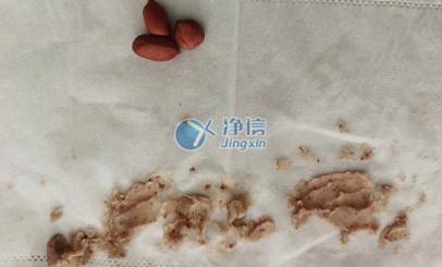 样品前处理实验效果